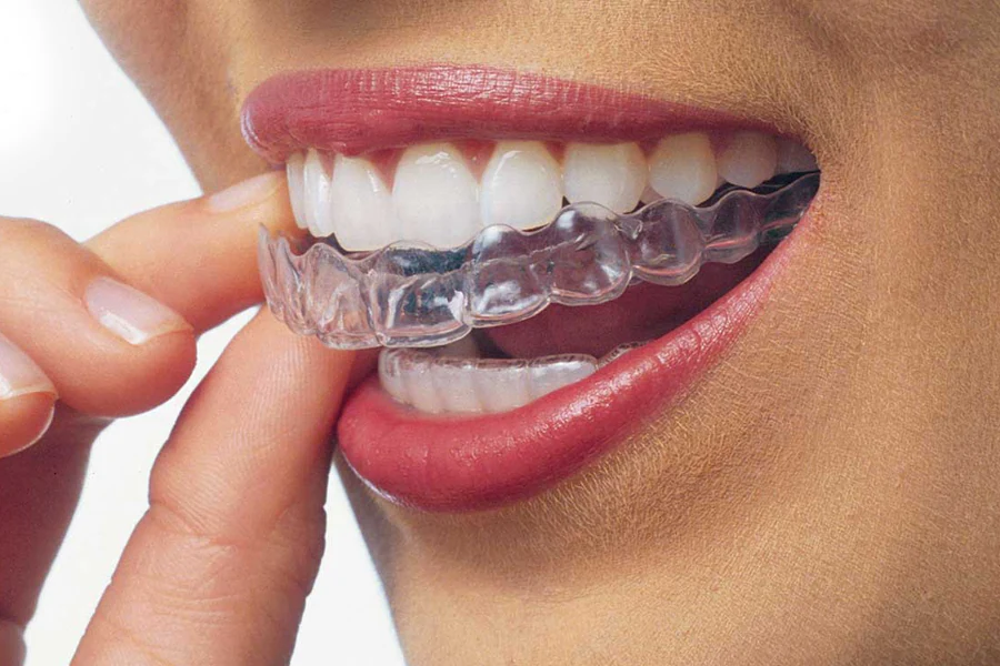 Person placing a clear aligner over their teeth